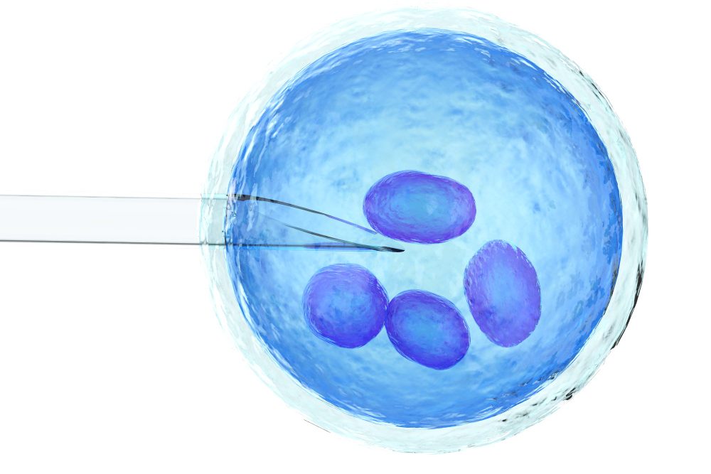 iVF1